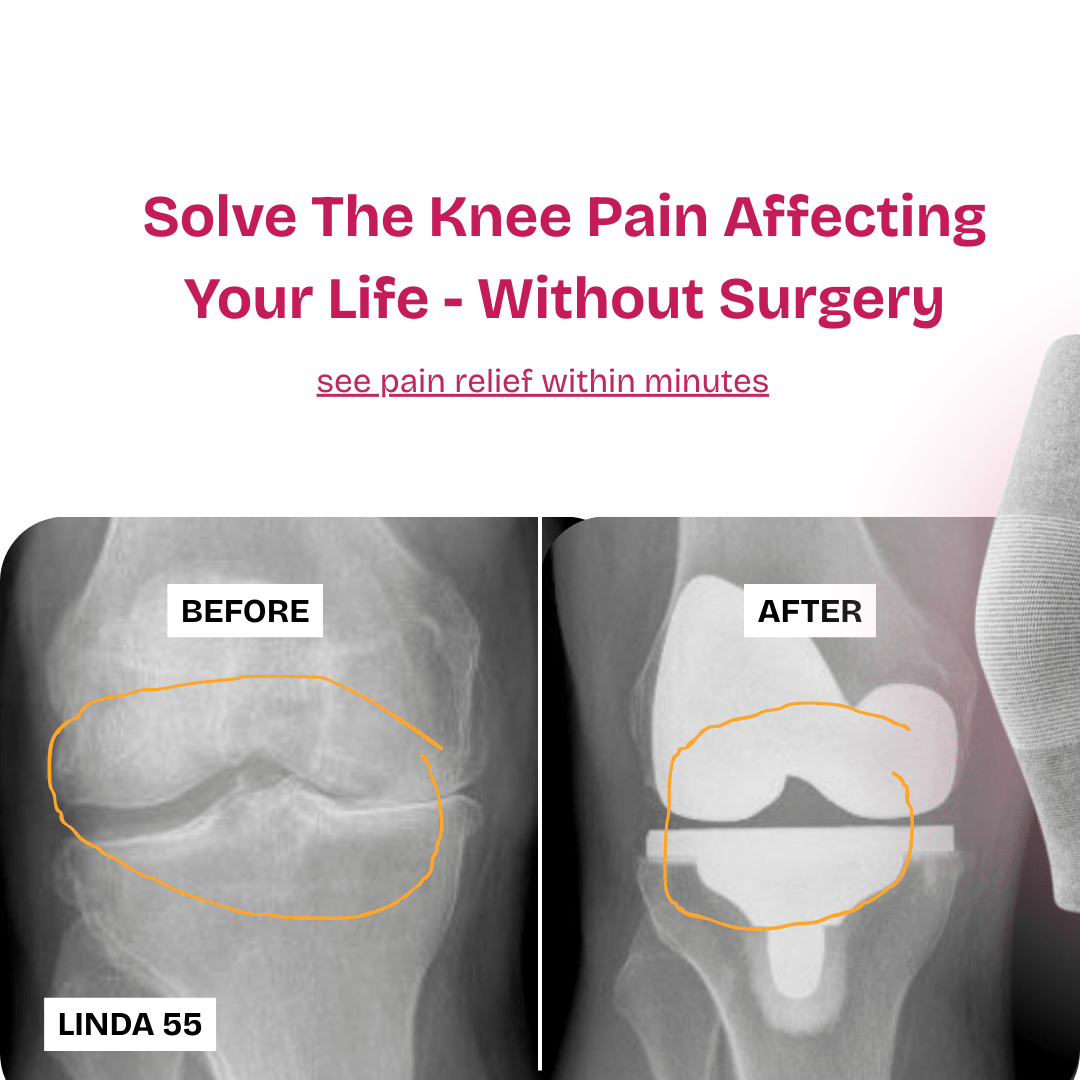 Viral Bamboo Knee Pain Relief Sleeve - Buy 1 Get 1 Free - Coreify