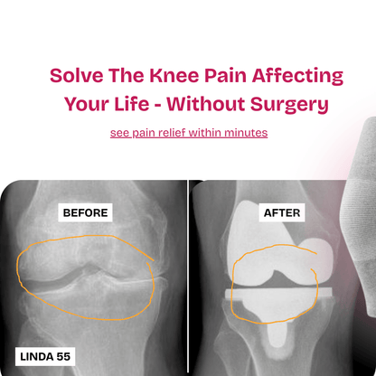 Viral Bamboo Knee Pain Relief Sleeve - Buy 1 Get 1 Free - Coreify